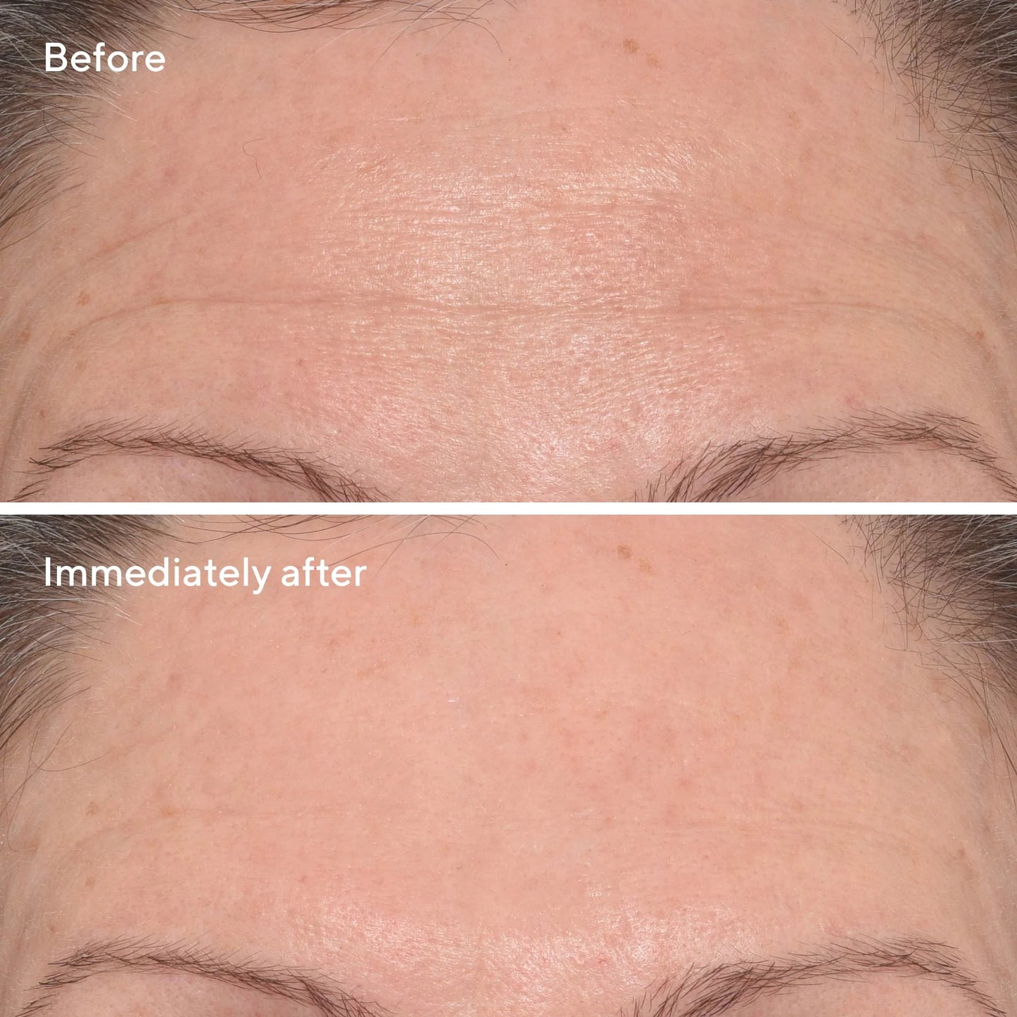 Murad Targeted Wrinkle Corrector 15ml