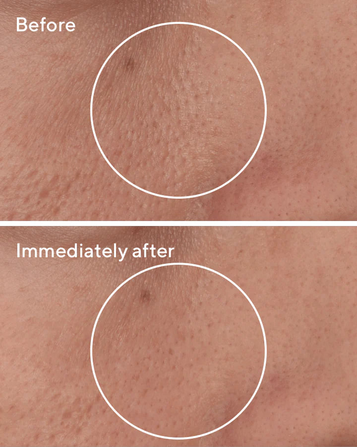 Targeted Pore Corrector