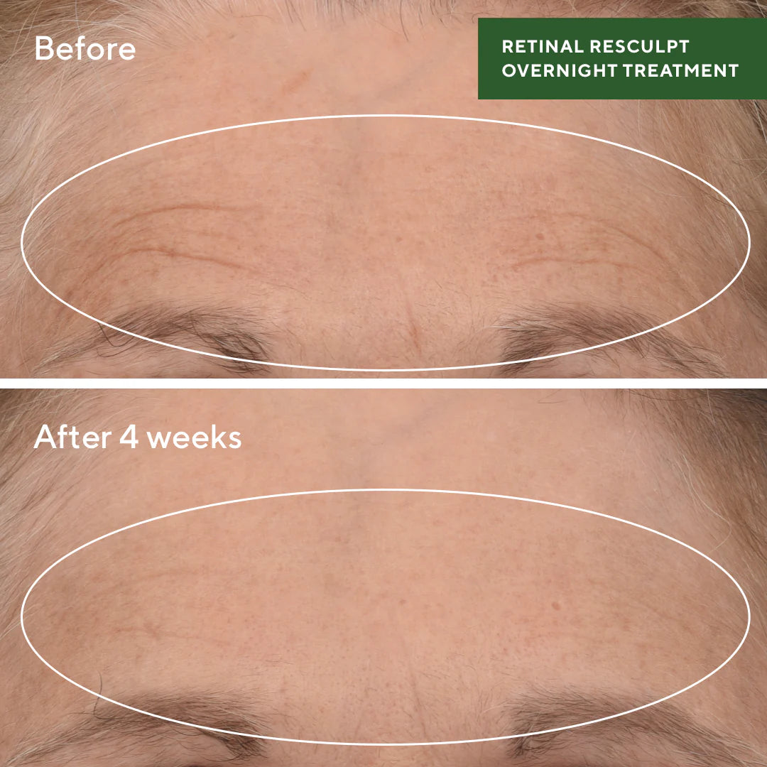 Retinal ReSculpt Overnight Treatment