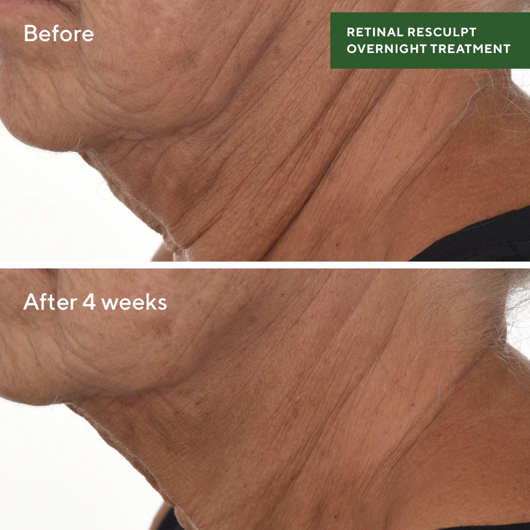 Retinal ReSculpt Overnight Treatment