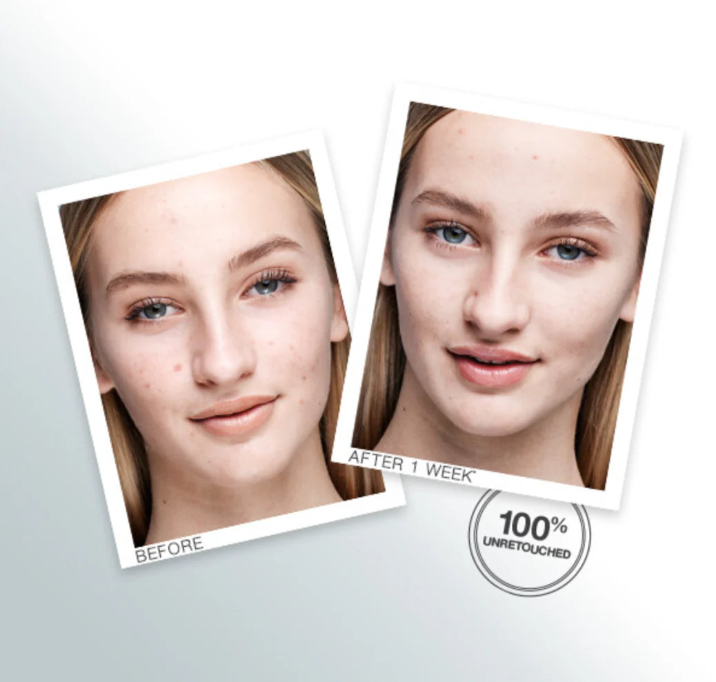 Murad Outsmart Blemish Clarifying Treatment 50ml