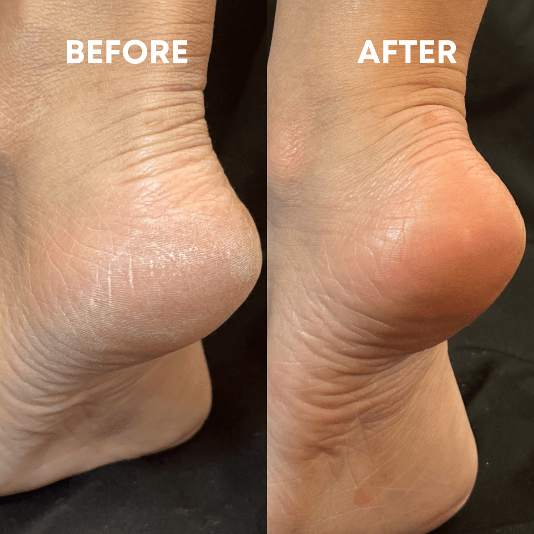 CheekyGlo Exfoliating Foot File