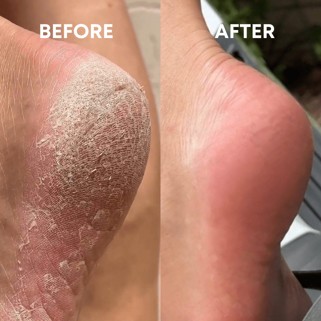 CheekyGlo Exfoliating Foot File