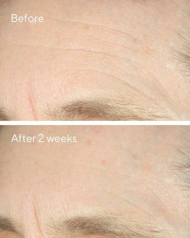 Murad Intense Recovery Cream 50ml
