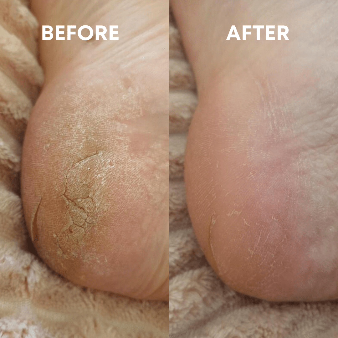 CheekyGlo Exfoliating Foot File