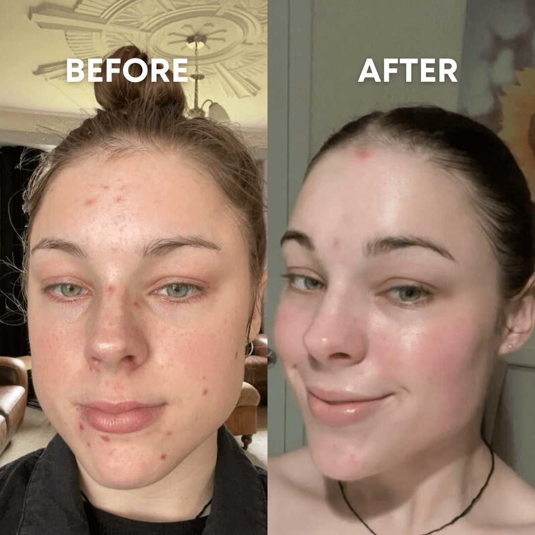 CheekyGlo Silk Exfoliating Face Mit